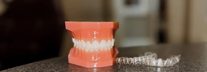 How Does Invisalign Work in Batavia IL? How Does Invisalign Work in Batavia IL?