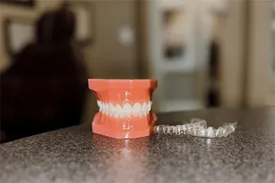 Orthodontist Batavia IL Types of Braces Invisalign Invisalign clear aligners and a mouth model for patient education