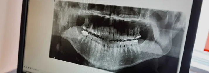 Types Of Braces in Batavia IL Types Of Braces in Batavia IL