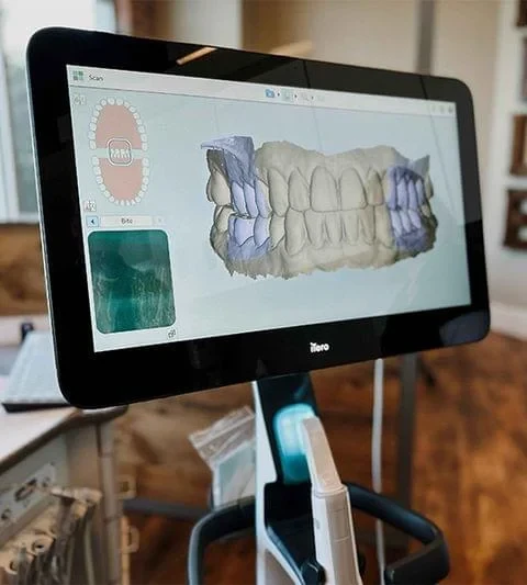 Orthodontist Batavia IL Wright Scanner The Wright Scanner, which provides a digital scan of a patient's mouth